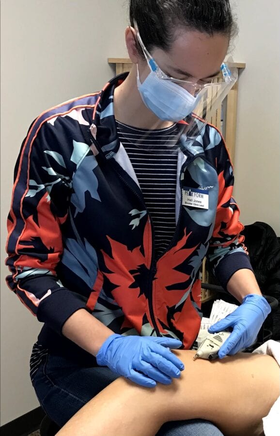 Physical therapist practices dry needling for pain relief.